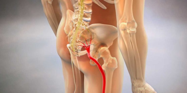 Pain in Legs After Back Surgery